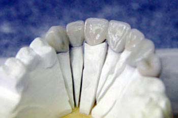 Proserve Dental Ceramics Chelmsford image 4
