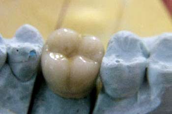 Proserve Dental Ceramics Chelmsford image 4